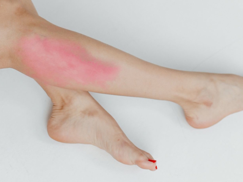 Pacjent pokrzepiający