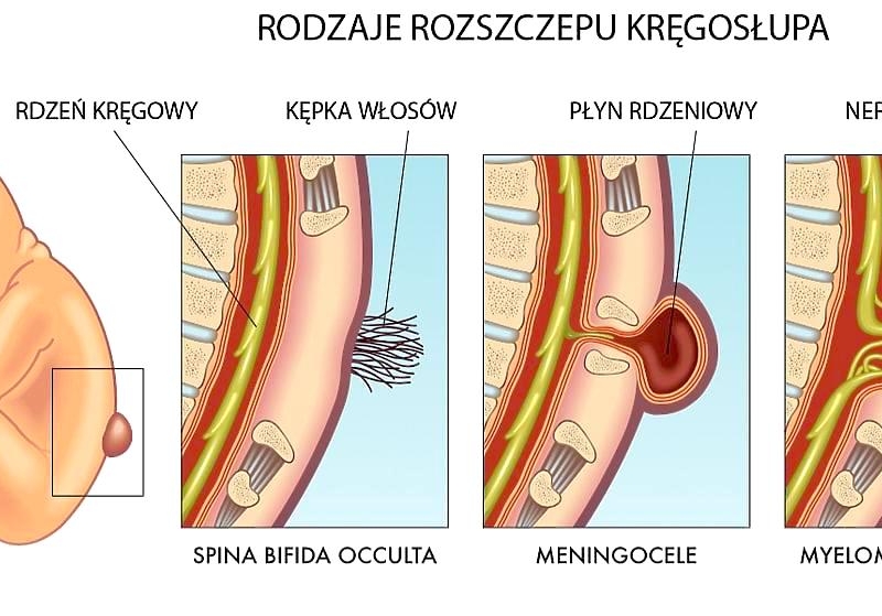 Rafałek i&nbsp;jego blizny