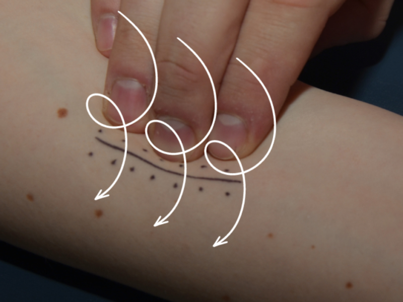 EBOOK: JAK LECZYĆ BLIZNY?