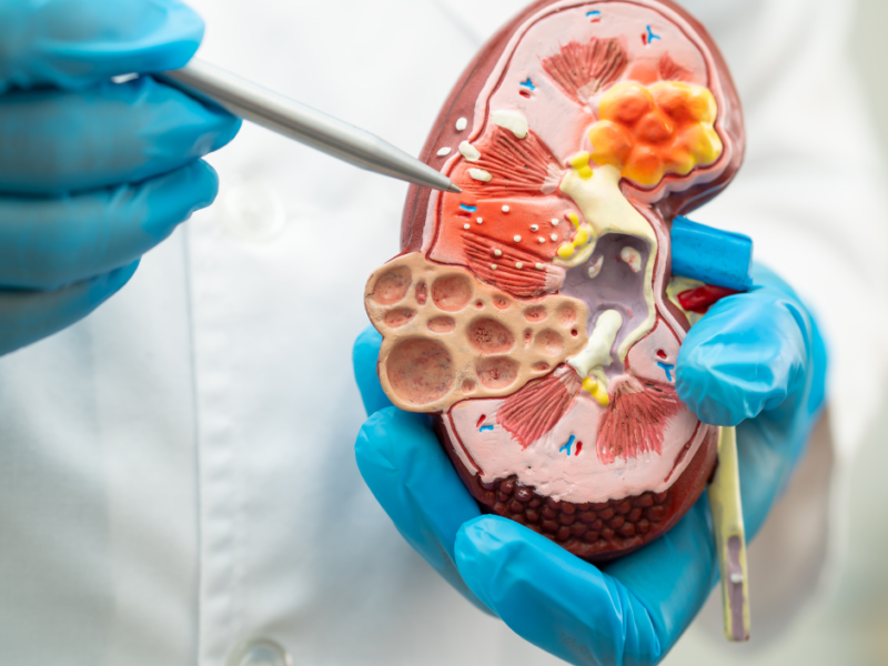 Rzutowanie bólu narządu wewnętrznego