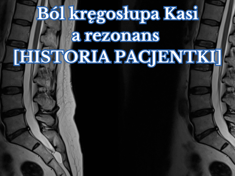 Ból kręgosłupa Kasi a&nbsp;rezonans [HISTORIA PACJENTA]