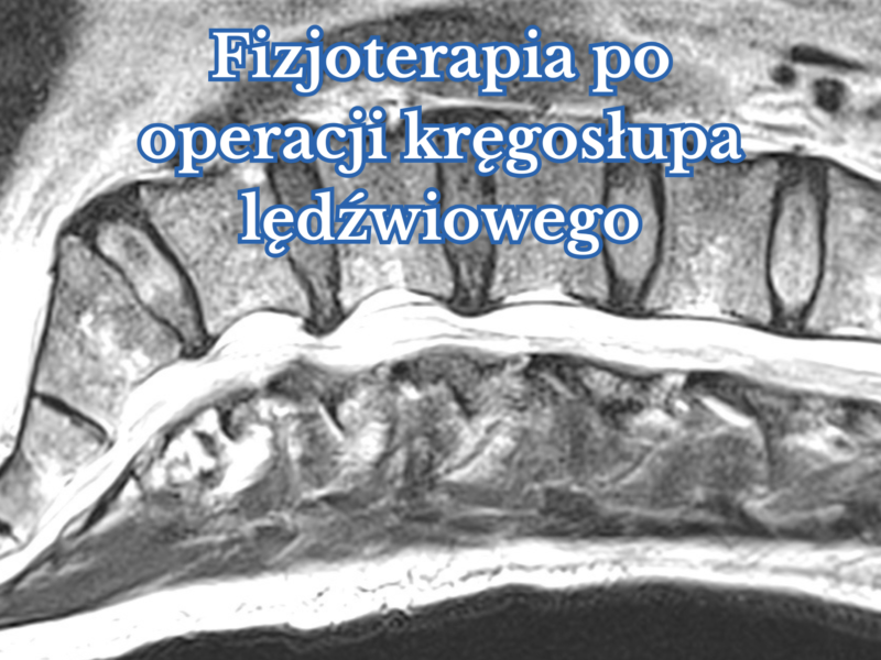 Fizjoterapia po&nbsp;operacji kręgosłupa lędźwiowego